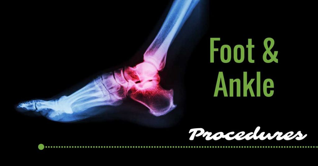 co-footankleprocedures Foot and Ankle Procedures