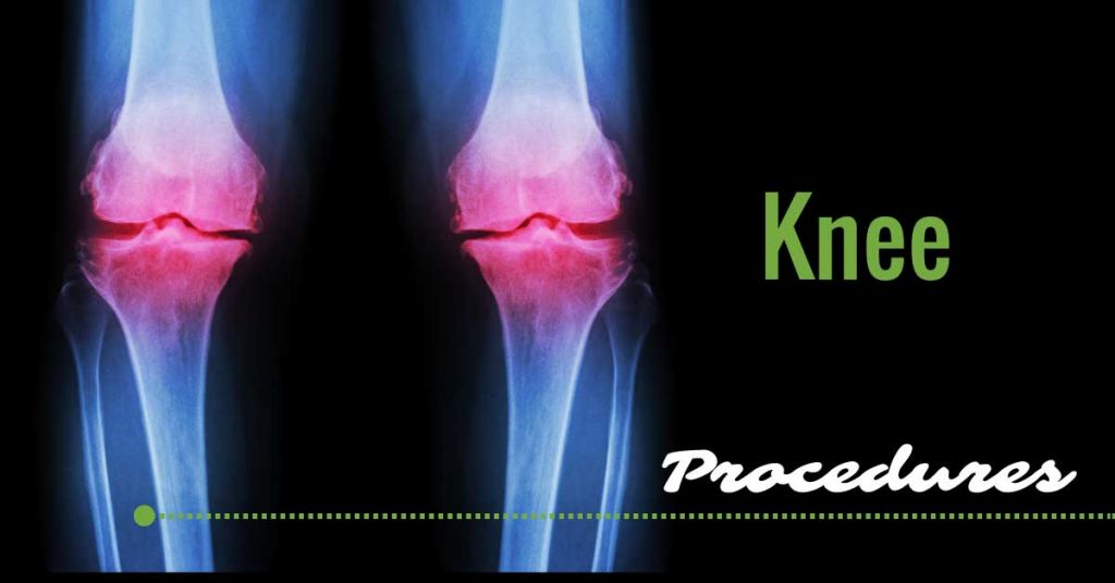 co-kneeprocedures