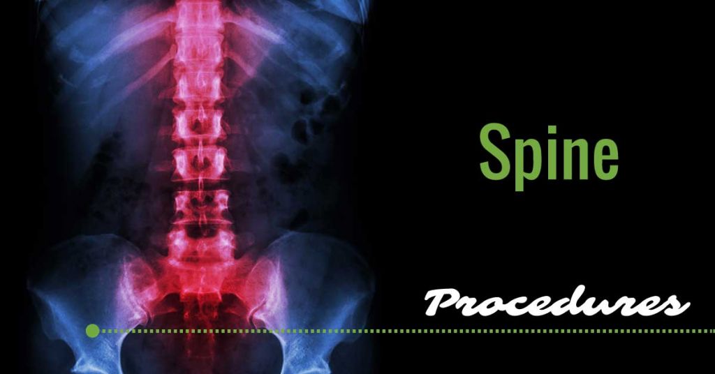 co-spineprocedures